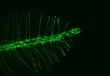 Raíz de Arabidopsis, y detalle de pelos radiculares. Aporte sensorial de las raíces