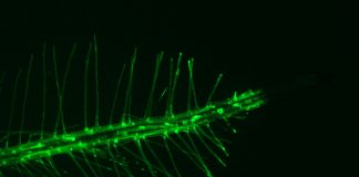 Raíz de Arabidopsis, y detalle de pelos radiculares. Aporte sensorial de las raíces