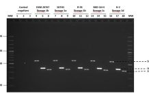 Colaboración entre PUC, UNAB e INCAR permitió desarrollar un nuevo protocolo de PCR multiplex