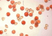 Columna de opinión | El enigma invernal del avellano europeo y la ciencia detrás de FloralNut Columna de opinión | El enigma invernal del avellano europeo y la ciencia detrás de FloralNut