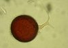 Tres años de seguimiento a hongos del suelo revelan la clave para restaurar suelos degradados en climas mediterráneos Tres años de seguimiento a hongos del suelo revelan la clave para restaurar suelos degradados en climas mediterráneos
